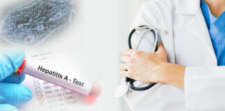 Brote de amibiasis y hepatitis A por la falta de agua en Venezuela La falta de agua en Venezuela- Cantineoqueteveonews