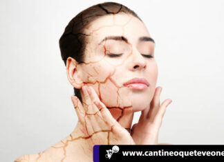 ¿Cuáles son los factores que causan la piel seca? ¡Entérate! Factores que causan la piel seca - cantineoqueteveo news