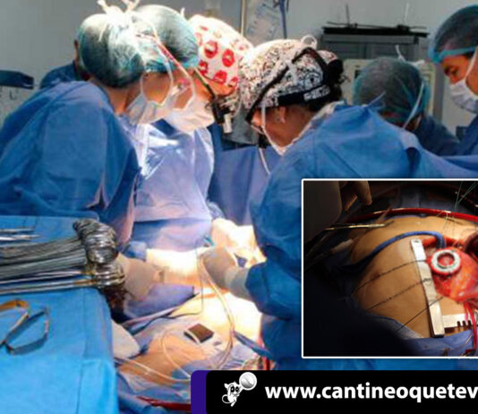 Niña Colombiana recibió con éxito implante de corazón artificial cantineoqueteveo - Niña Colombiana recibio con exito implante de corazon artificial
