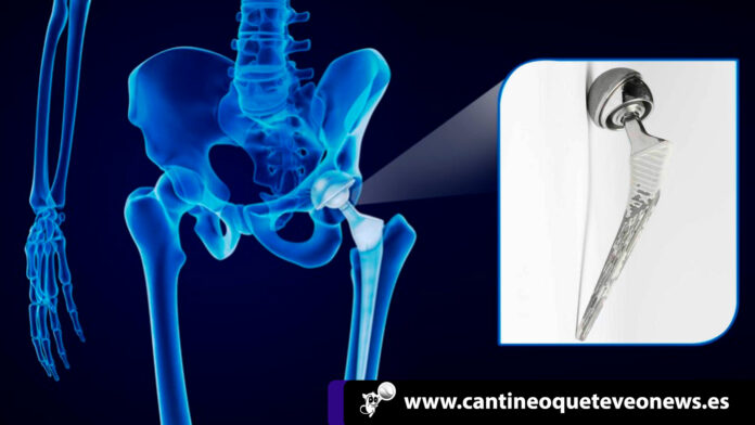 cantineo-web-investigación-a-johnson-&-johnson-por-protesis-defectuosa cantineoqueteveo news - Investigación a Johnson & Johnson