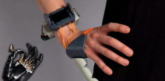 protesis de dedos robóticos - Cantineoqueteveonews