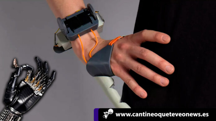 protesis de dedos robóticos - Cantineoqueteveonews