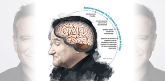 Cuerpos de Lewy: La rara demencia que acabó con el actor Robin Williams Cuerpos de Lewy - Cantineoqueteveonews
