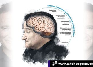 Cuerpos de Lewy: La rara demencia que acabó con el actor Robin Williams Cuerpos de Lewy - Cantineoqueteveonews